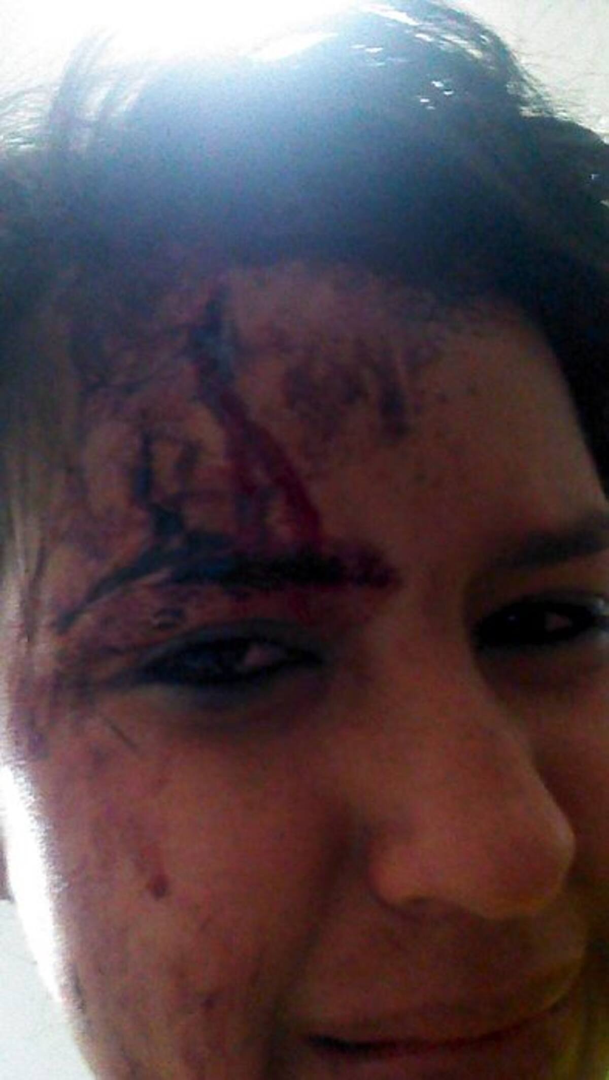 Denuncian agresión contra mujer en Santander (Foto: Suministrada/VANGUARDIA LIBERAL)