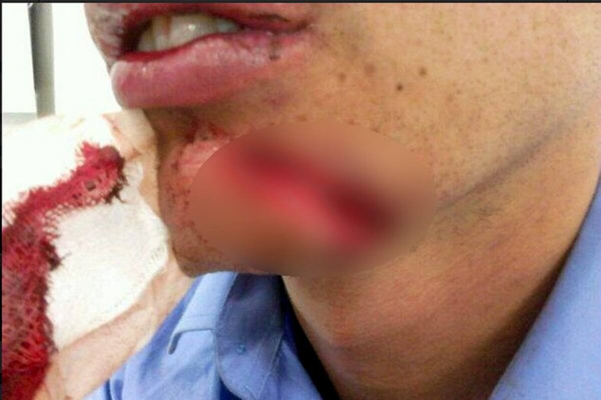 Actor Mauricio Bastidas fue brutalmente golpeado (Foto: Tomada de Internet / VANGUARDIA LIBERAL)