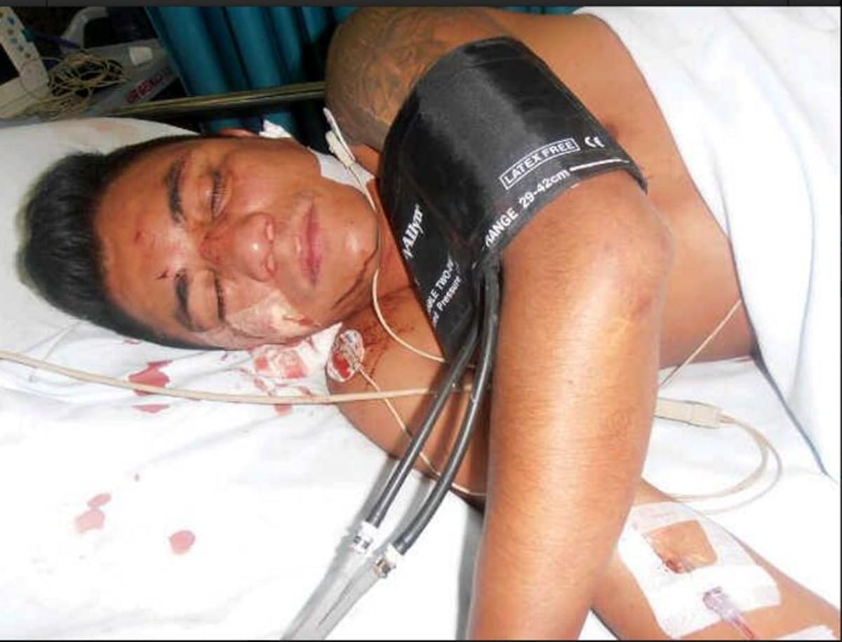 Actor Mauricio Bastidas fue brutalmente golpeado (Foto: Tomada de Internet / VANGUARDIA LIBERAL)