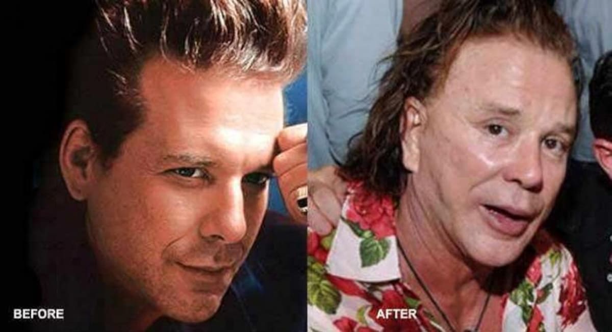 Mickey Rourke (Foto: TOMADA DE INTERNET/VANGUARDIA.COM)