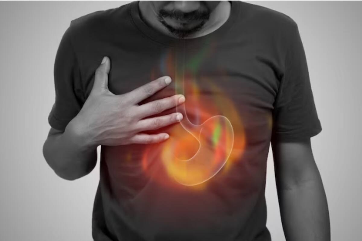 La gastritis ocurre cuando el revestimiento del estómago resulta hinchado o inflamado.