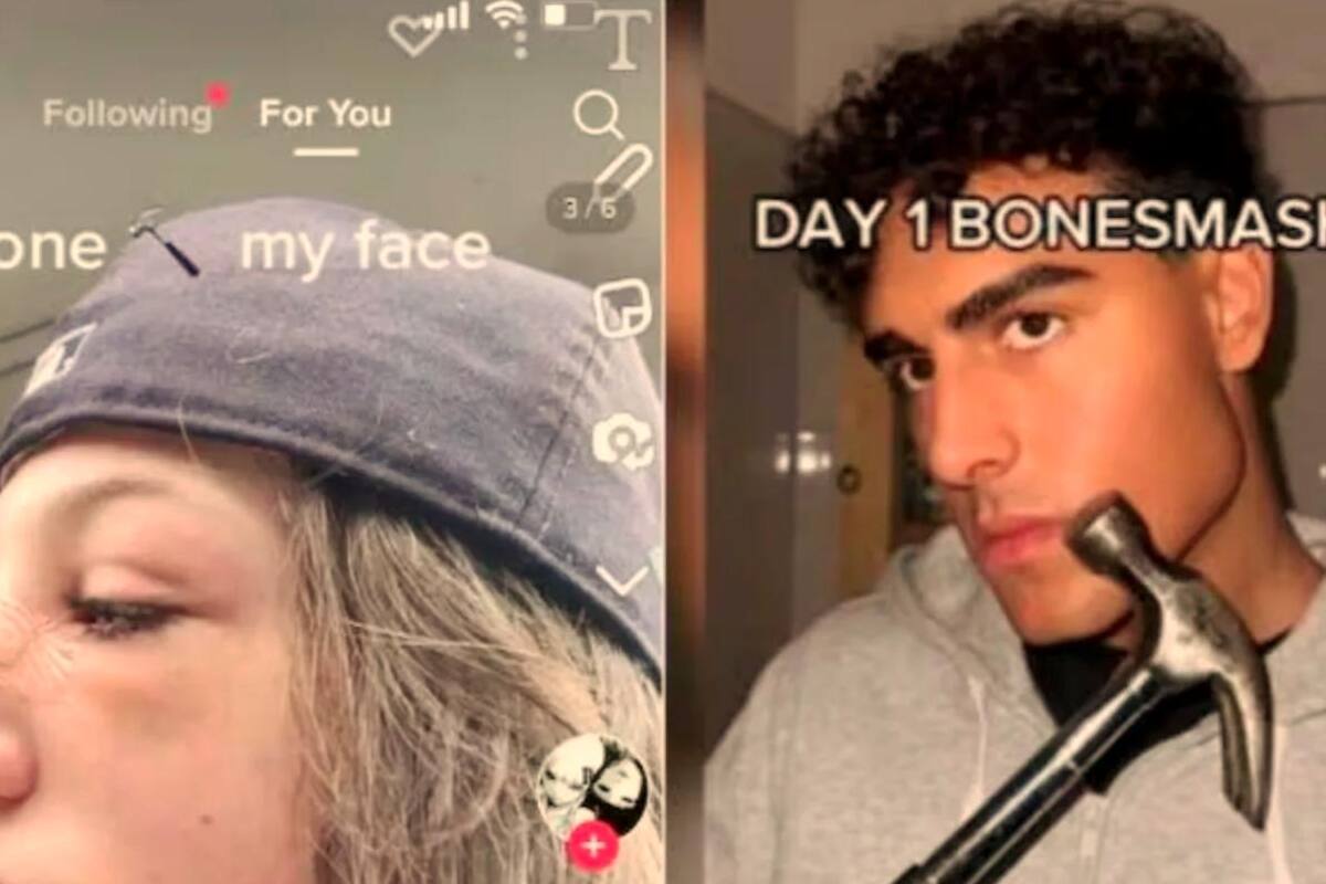 Ante esta alarmante tendencia en TikTok, los expertos hacen un llamado a la responsabilidad y la conciencia de los riesgos que conlleva este tipo de retos virales. Fotos tomadas de redes sociales/VANGUARDIA