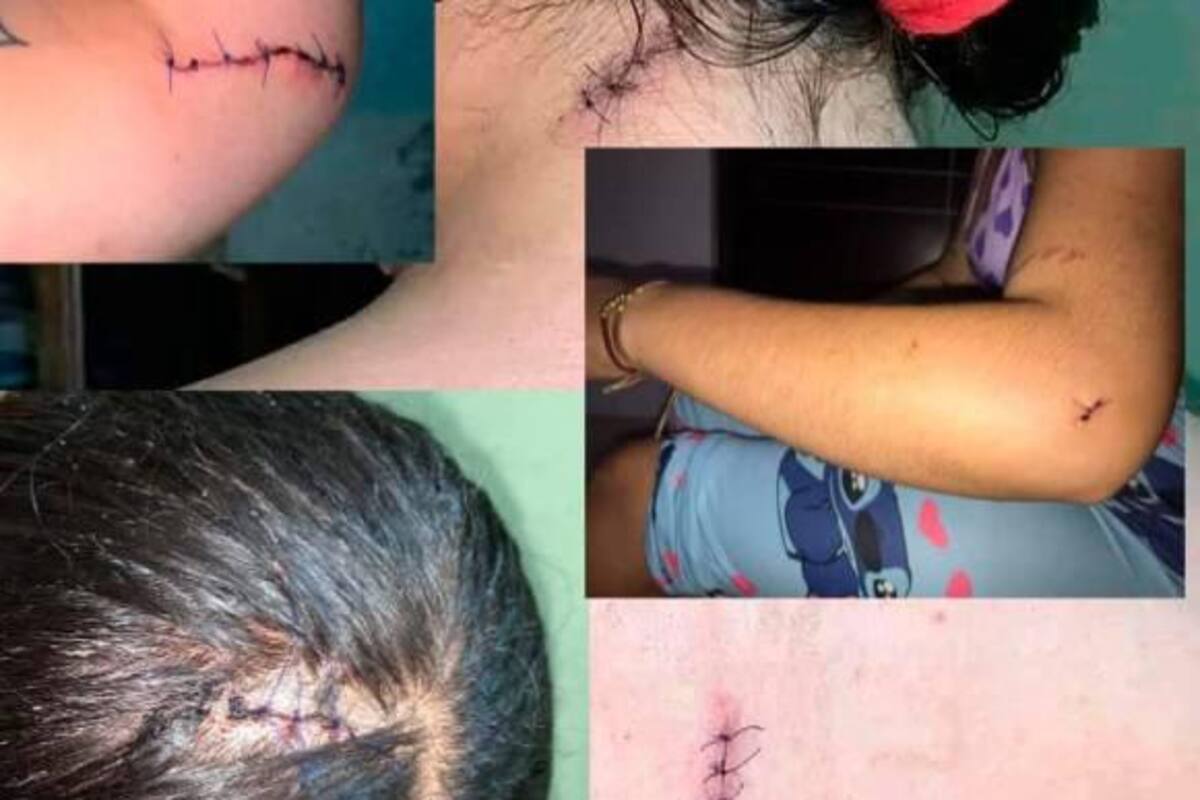 La mujer atacó a Sheirin Natalia con un cuchillo de unos 15 centímetros de largo. Foto: Cortesía/VANGUARDIA