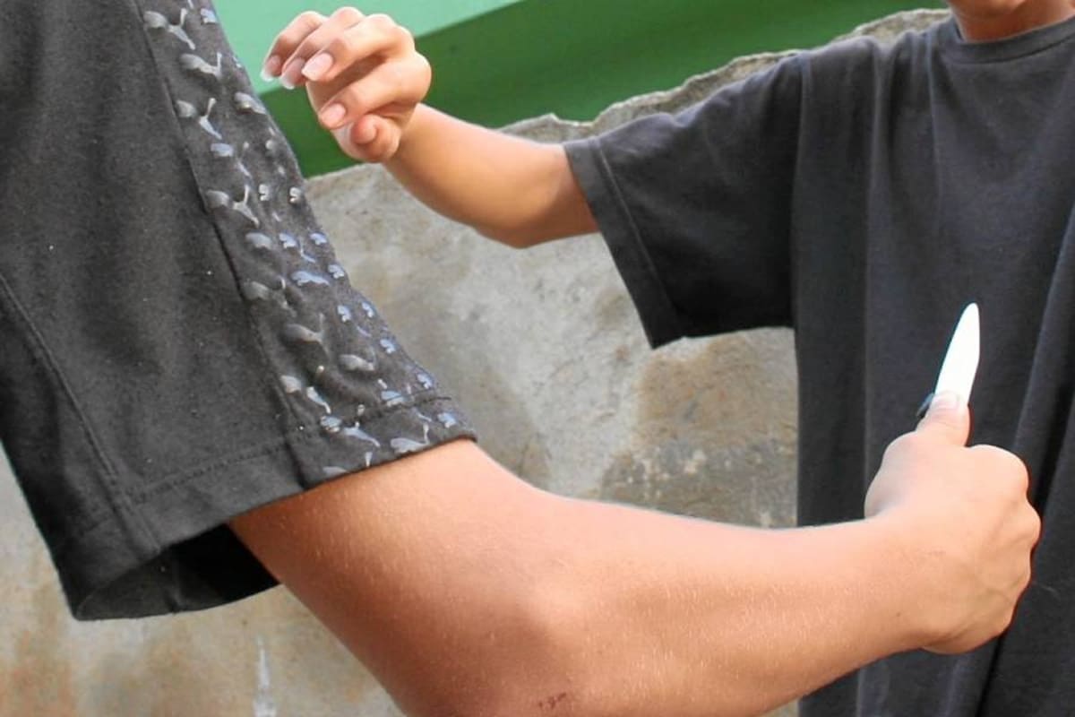 Hombre fue herido con arma cortopunzante en Bucaramanga: esto se sabe (Foto: Archivo)