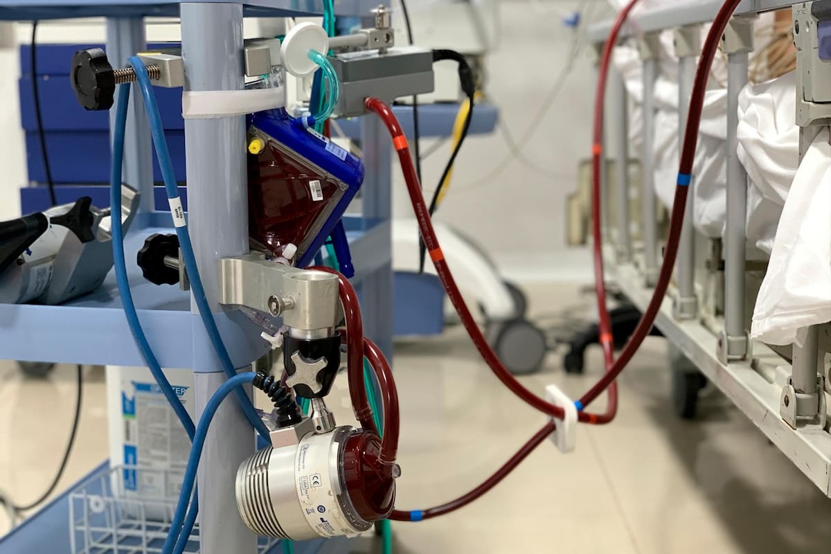 La FCV registra uno de los índices más altos de sobrevida en pacientes con COVID-19 que han requerido terapia ECMO y eso fue justo lo que le valió el reconocimiento como el mejor hospital latinoamericano en el manejo de esta tecnología. (Foto: Suministrada / VANGUARDIA)