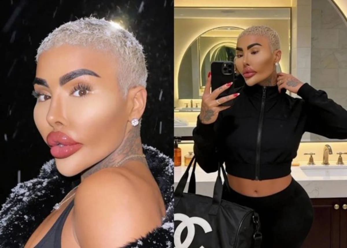Fallece el “Rey de los Labios”, influencer británico tras presuntas complicaciones de cirugía estética.