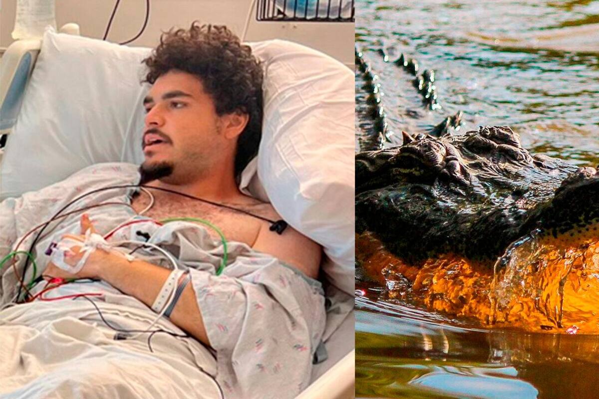 Jordan Rivera resultó herido gravemente luego de ser atacado por un caimán, esto luego de orinar detrás de un bar en la Florida. Internet / VANGUARDIA