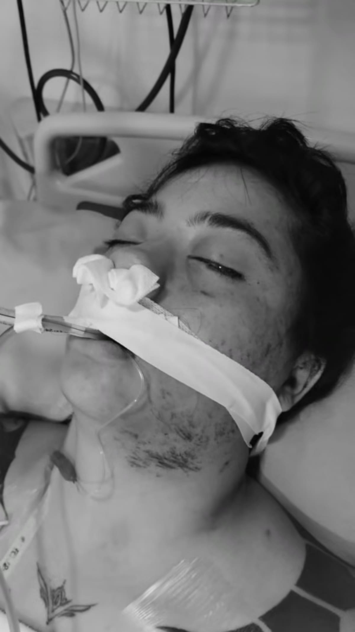 Joven denuncia intento de feminicidio tras ser lanzada desde un quinto piso en Soacha. | foto: Q' Hubo Bogotá.