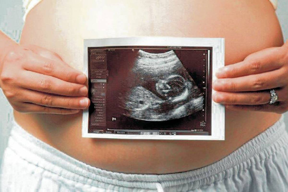 El diagnóstico prenatal permite detectar cada día más fetos y neonatos con dilatación de los sistemas excretores renales, pero la mayoría de los casos son ectasias transitorias en la vida intrauterina que desaparecen en los primeros meses de la vida posnatal. (Foto: Suministrada / Vanguardia Liberal)