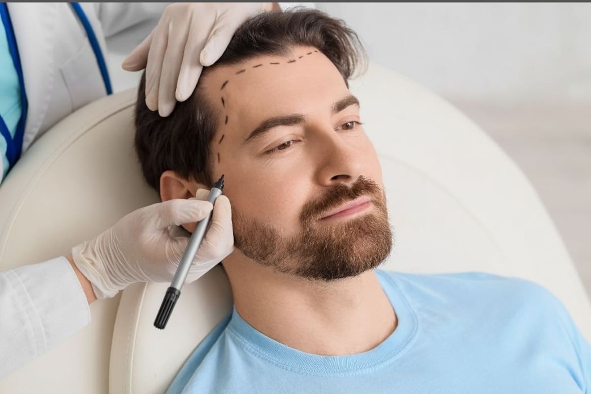 La nueva técnica para recuperar cabello sin raparse y volver rápido a la rutina diaria. | Foto: Vanguardia / Canva
