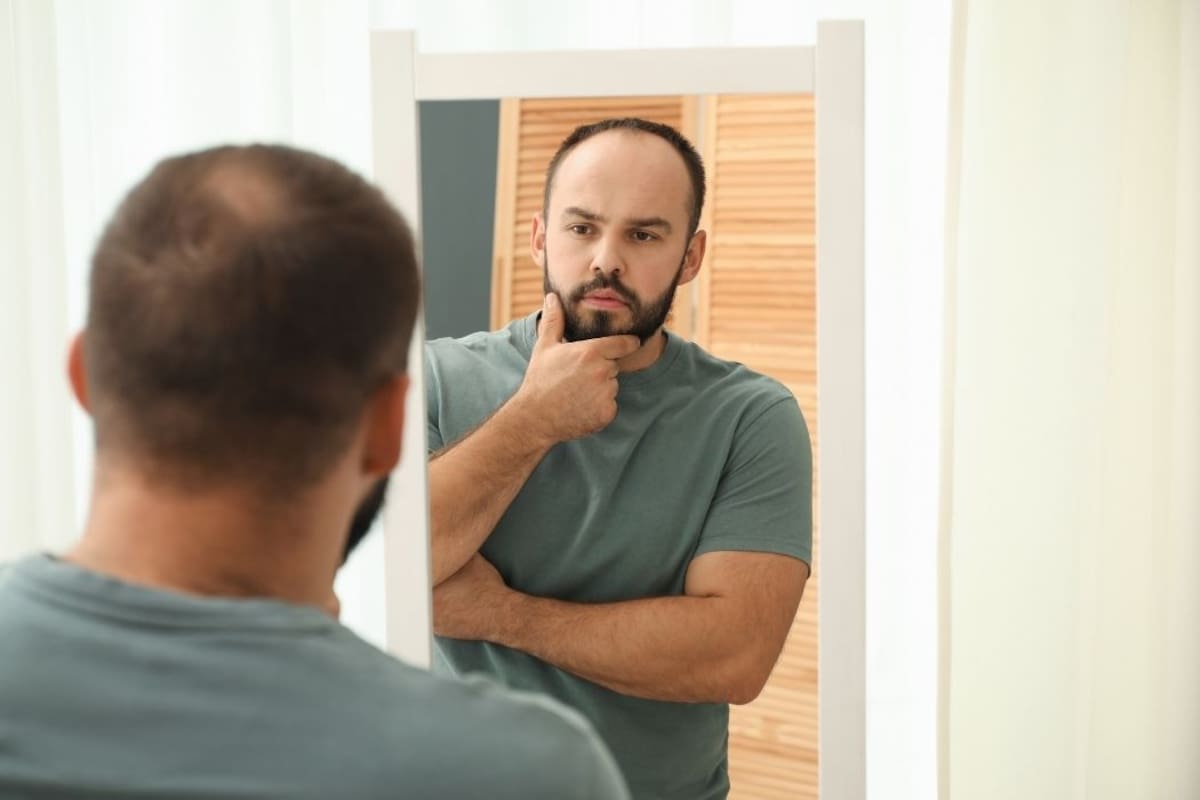 La nueva técnica para recuperar cabello sin raparse y volver rápido a la rutina diaria. | Foto: Vanguardia / Canva