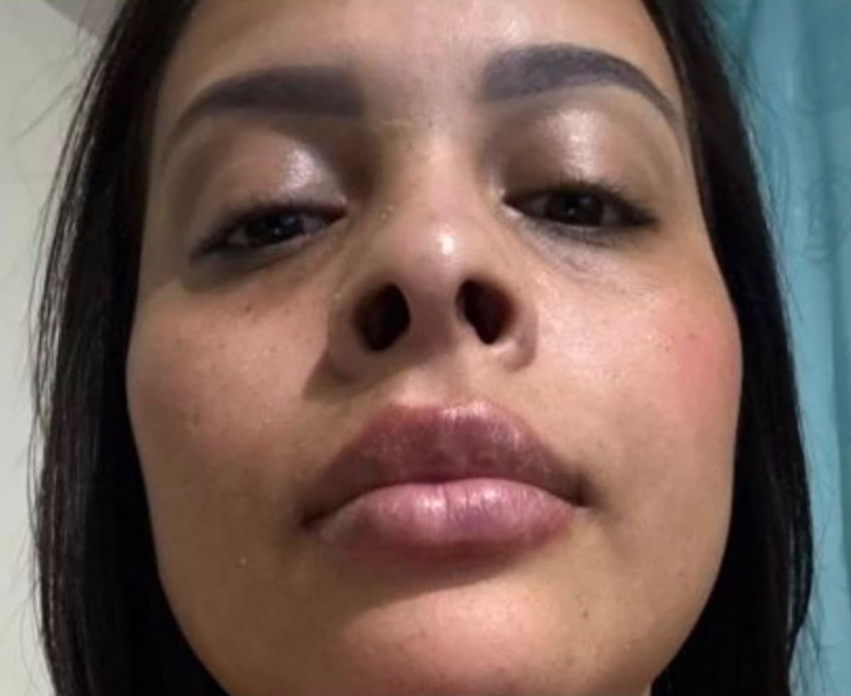 La pesadilla detrás de una oferta estética en Bucaramanga