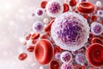 Estos son los síntomas de alerta de la leucemia que no deberían pasar desapercibidos