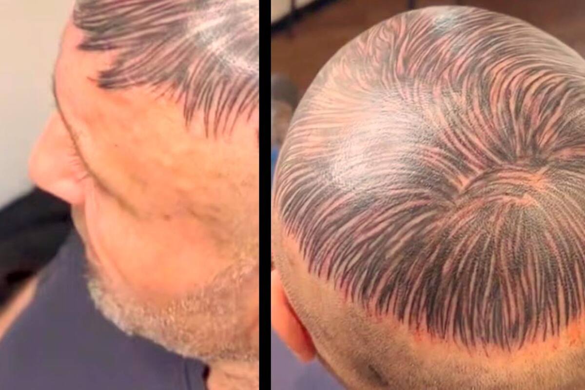 Un hombre ha transformado su inseguridad en una declaración de estilo, demostrando que la belleza realmente viene en todas las formas y tamaños. Fotos tomadas de redes sociales/VANGUARDIA
