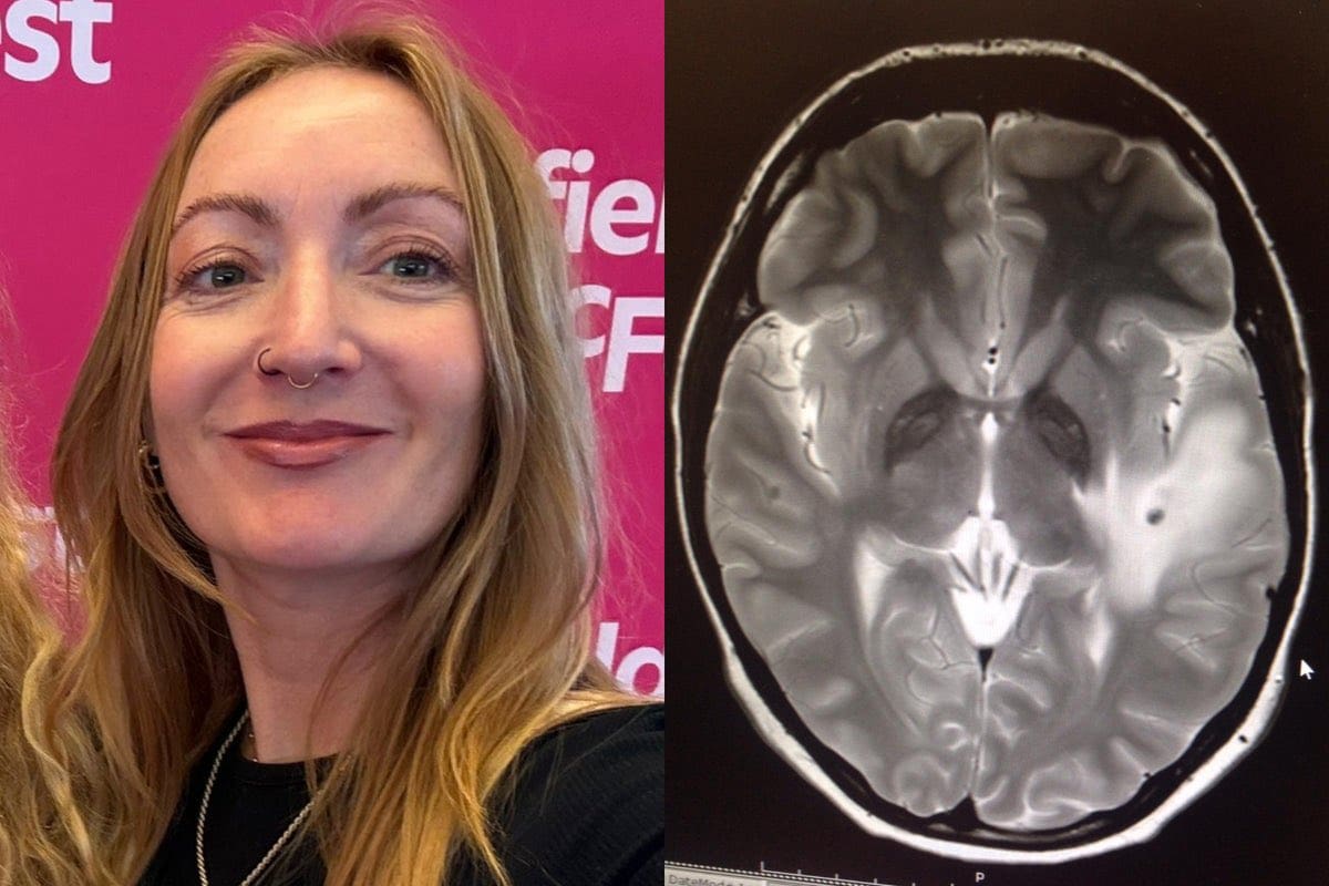 Una mujer galesa, Lowri Denman, pasa tres meses de vacaciones en India y regresa con 38 parásitos en su cerebro.