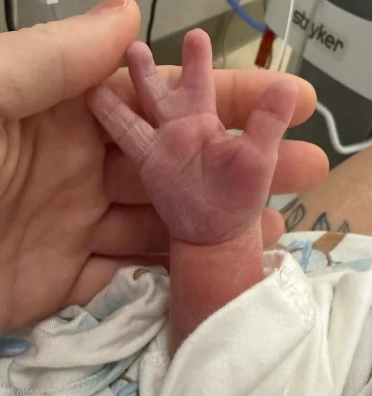 Los padres del recién nacido decidieron compartir su historia en redes sociales para visibilizar la simbraquidactilia y promover un mensaje de aceptación y orgullo por las diferencias congénitas.
Foto tomada de: Pantallazo de Instagram@accidentescartagena_