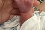 Bebé nace con una extraña malformación en la mano y conmueve en redes
