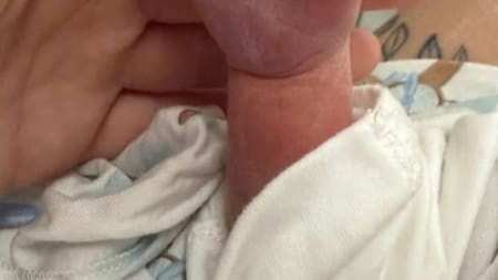 Bebé nace con una extraña malformación en la mano y conmueve en redes