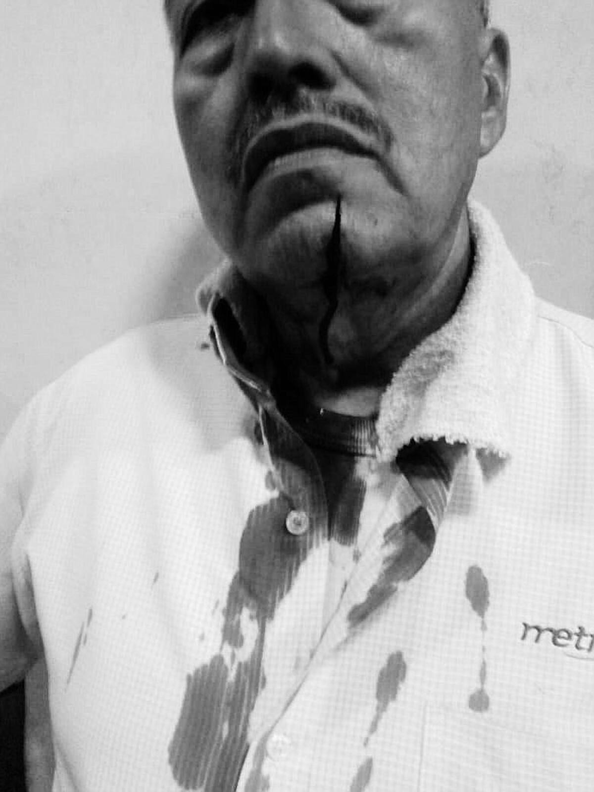 Tras la golpiza que recibió, Carlos Alberto tuvo que ser trasladado a un centro asistencial. (Foto: suministrada / VANGUARDIA)