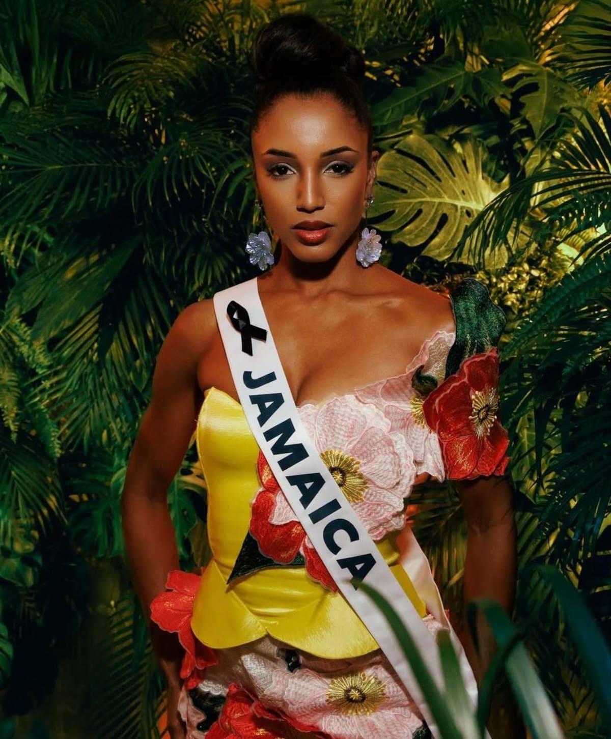 Miss Jamaica permanece en UCI. // Redes sociales - IG - @Officialgabriellehenry