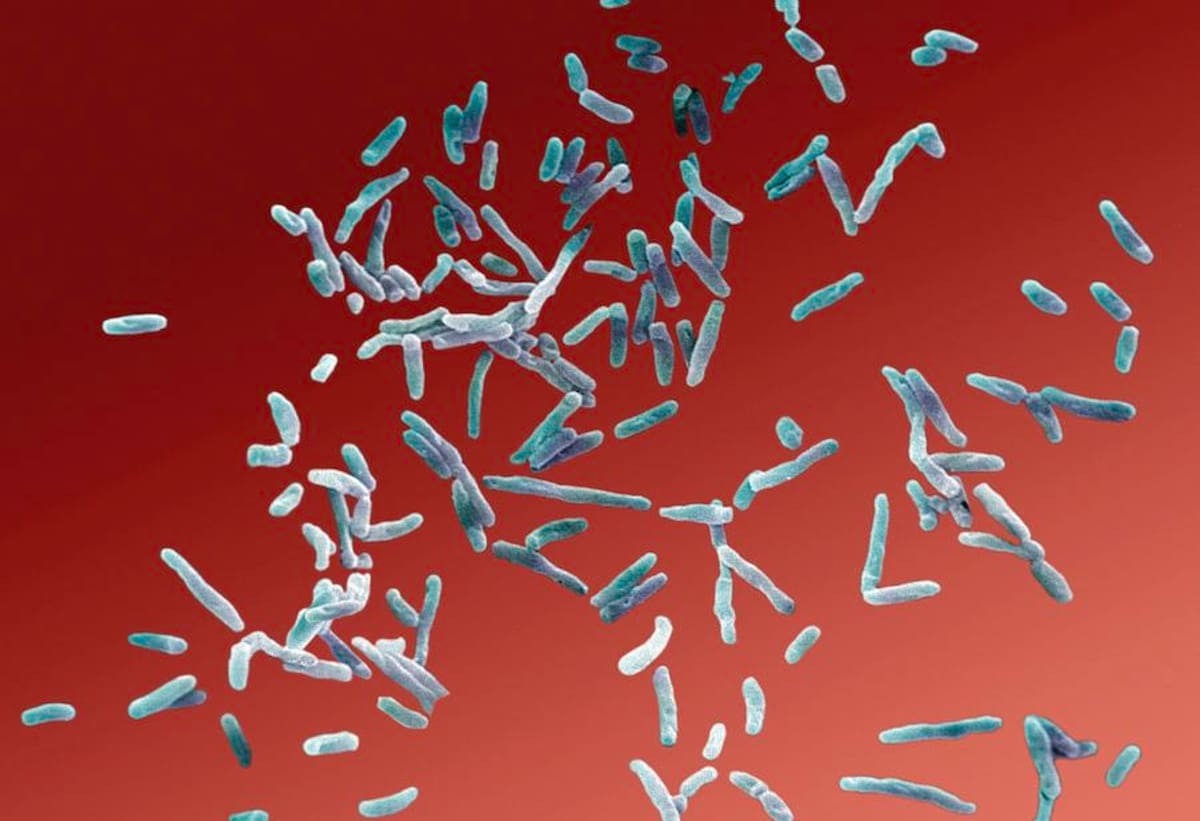 Clínica estética clandestina infectó con Mycobacterium chelonae, a decenas de mujeres en Medellín.