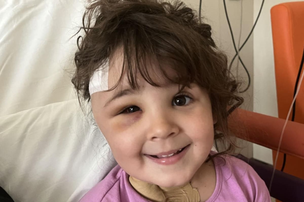 La pequeña Sara fue sometida en España a una compleja cirugía para extraerle una aguja que se alojó en su cerebro. Tomada de internet / VANGUARDIA