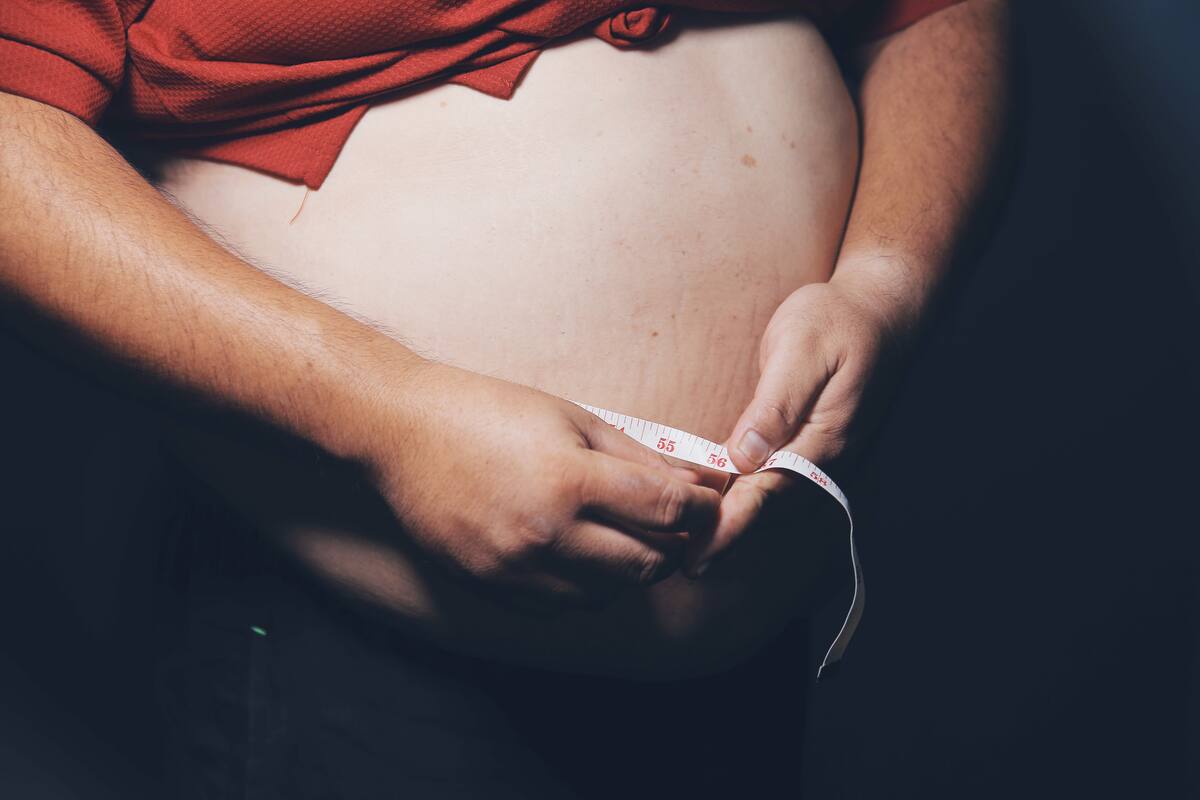 El número de kilos que el paciente debe reducir, la edad y las enfermedades de base son aspectos claves para determinar el tratamiento de la obesidad. //123RF.