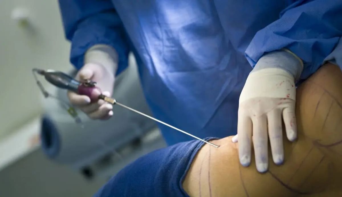 Fiscalía suma cargos a tres mujeres por red de cirugías estéticas ilegales en Medellín.