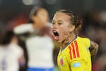 Ana María Guzmán recibió un duro golpe con la Selección Colombia: su mensaje tras la grave lesión