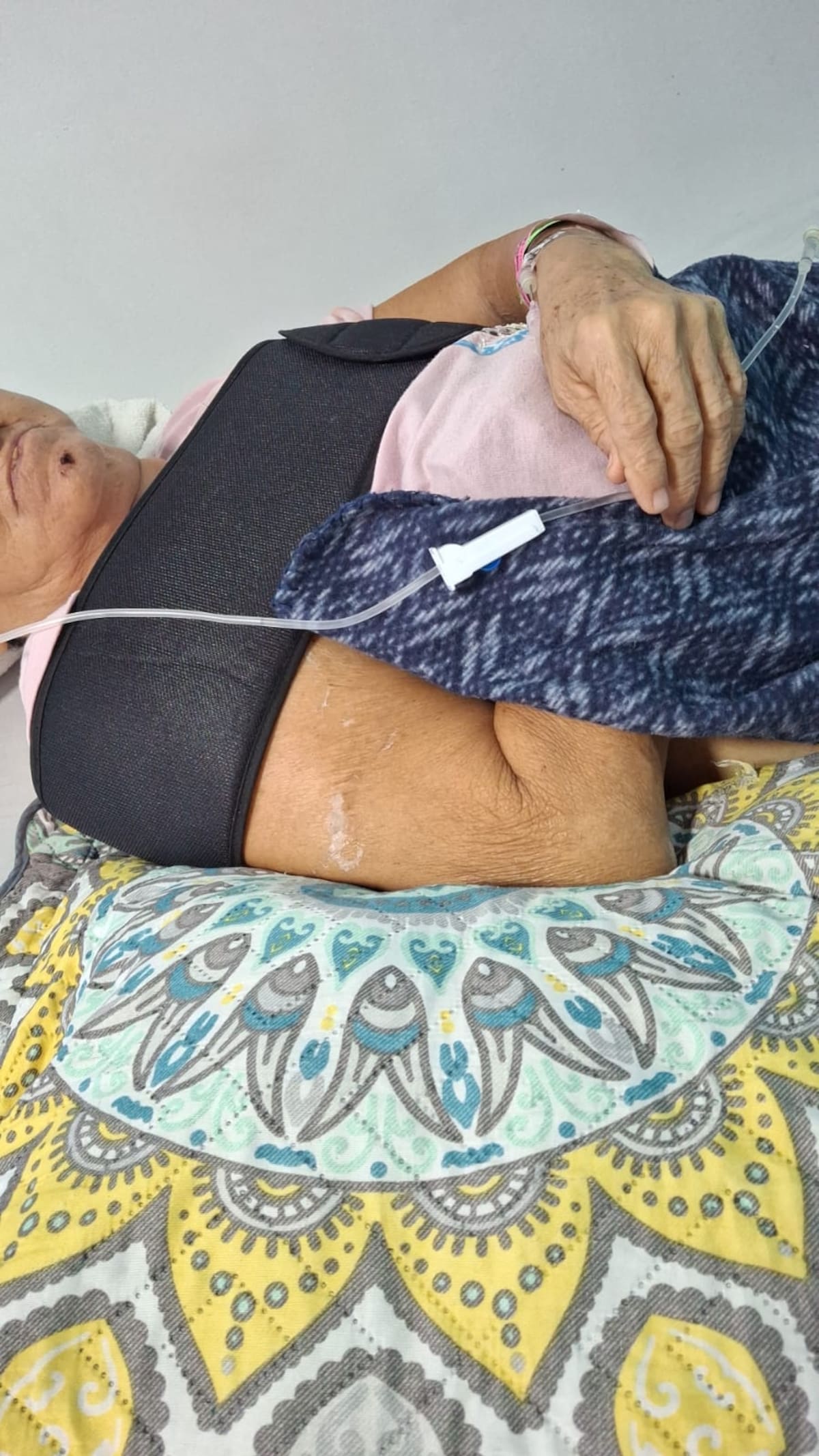 Una adulta mayor sufrió una fractura luego de caer sobre una zona donde una losa se encontraba levantada. El hecho ocurrió en el Parque de la Vida de Barrancabermeja.
Lesly Cifuentes/Vanguardia