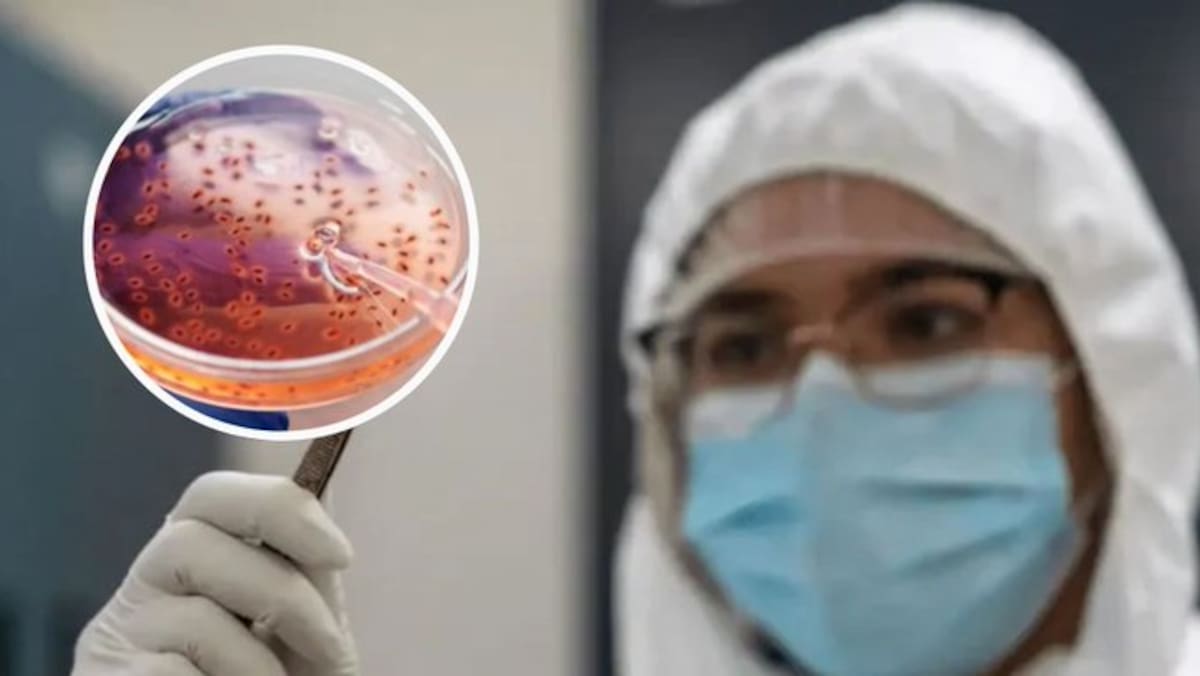 La peste neumónica es causada por la bacteria Yersinia pestis y puede transmitirse fácilmente de persona a persona a través de partículas respiratorias.
