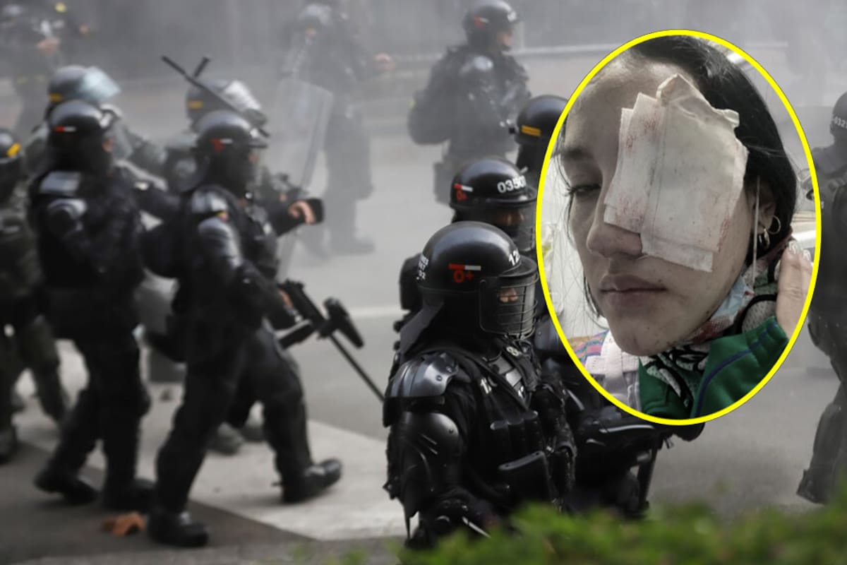 Condena por abuso policial en el estallido social de 2021.
Foto: Colprensa/redes sociales.