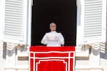 Papa León XIV anunció que deberá someterse a una cirugía en los próximos días