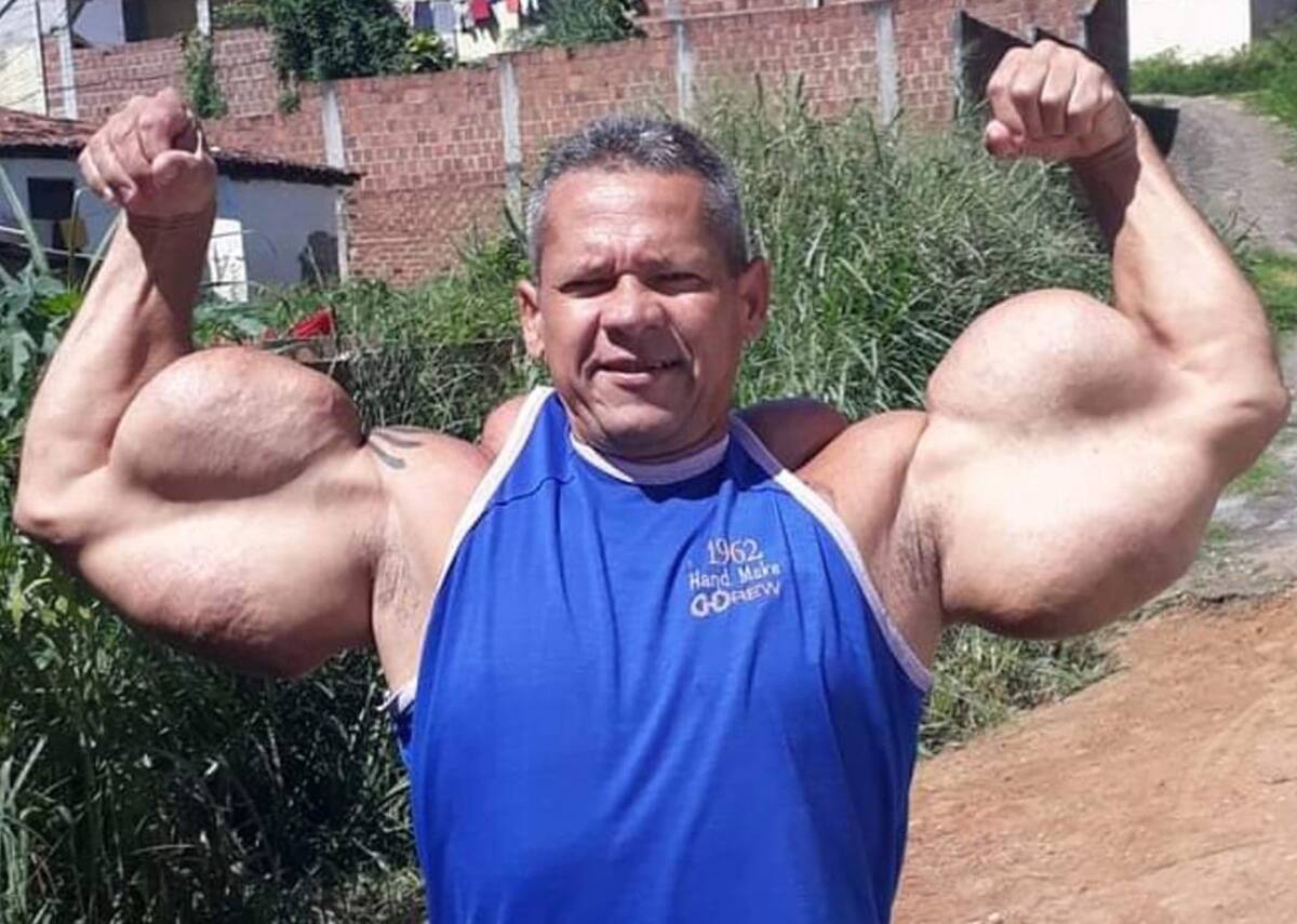 Muere con sólo 55 años el ‘Popeye brasileño’, que había ganado fama en Brasil tras inyectarse aceite mineral en su propio cuerpo para hacerse más fuerte.