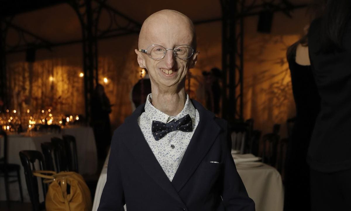 Qué es la progeria, la extraña enfermedad que padecía Sammy Basso. Foto tomada de redes sociales/VANGUARDIA