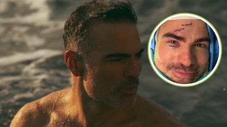 Accidente en plena obra: Actor de ‘Sin senos sí hay paraíso’ terminó en el quirófano