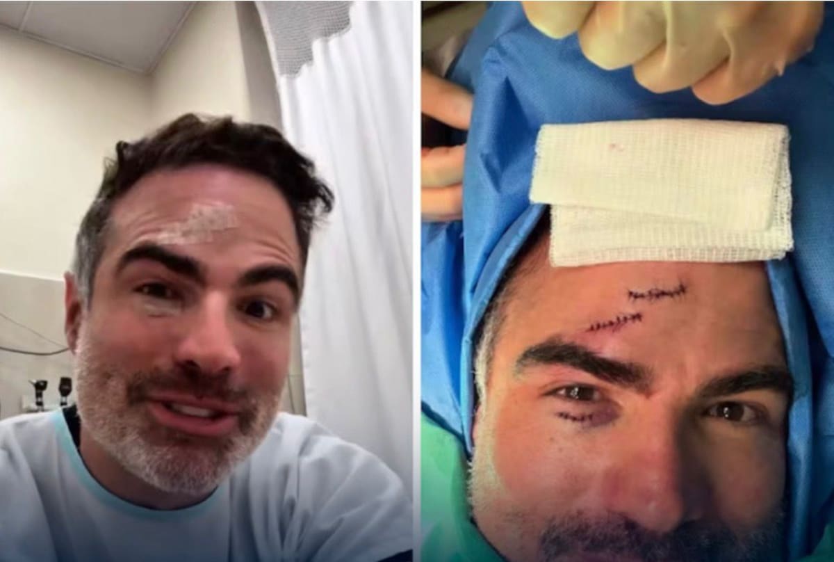 Actor Roberto Manrique sufre fuerte accidente en pleno escenario y termina en cirugía de emergencia.