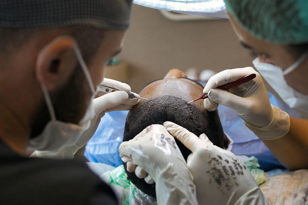 Cada vez más personas consideran viajar a otros países para tratar la alopecia o realizarse un trasplante capilar. Colombia busca posicionarse como una alternativa en este mercado internacional.