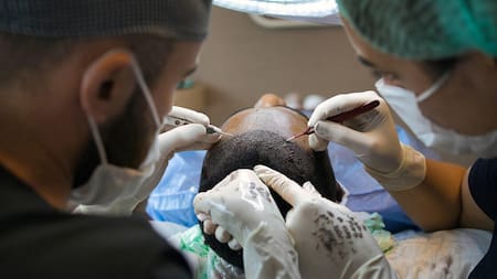 Turismo capilar: Colombia busca atraer a pacientes extranjeros que viajan para recuperar su cabello