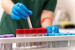 Santander, tercero en casos de dengue en el país