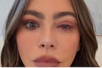 Sofía Vergara aparece con un ojo inflamado: la razón de ausencia en los Emmy