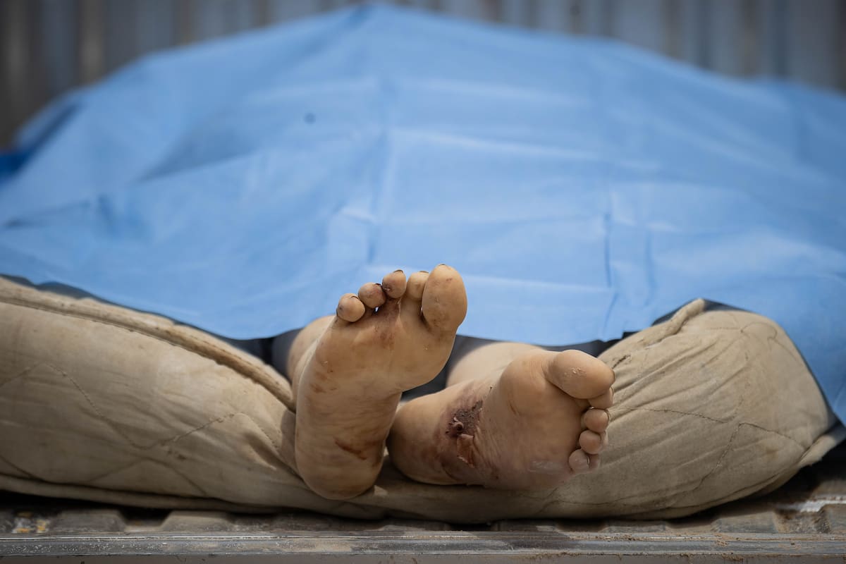 AME4336. LA GUAIRA (VENEZUELA), 25/06/2026.- Fotografía que muestra los pies de una víctima mortal este jueves, en La Guaira (Venezuela). El número de fallecidos en Venezuela a causa de los dos terremotos del miércoles se elevó a 188 y el de heridos a 1.520, mientras que al menos 346 construcciones, entre edificios, hospitales y centros comerciales, resultaron afectadas, informó el presidente de la Asamblea Nacional (AN, Parlamento), el chavista Jorge Rodríguez. EFE/ Ronald Peña R.