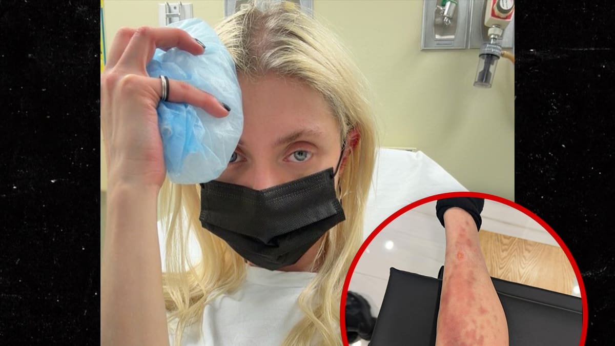 La cantante y actriz Taylor Momsen publica foto y video de una fea picadura de araña que la llevó al hospital.