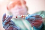Alerta por virus Shamonda: Francia confirma su primera victima y España reporta nuevos focos