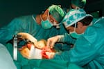 Un paciente trasplantado de hígado en Italia supera con éxito la extirpación de un tumor de páncreas