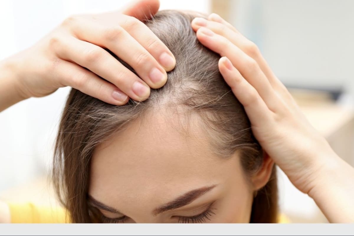 Tres cambios en el cabello podrían revelar enfermedades antes de presentar otros síntomas. | Foto: Vanguardia / Canva