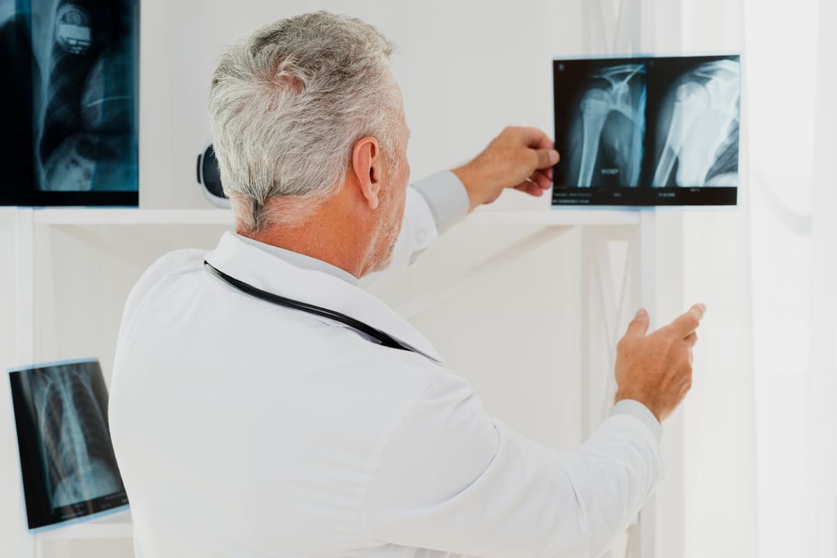 Un tumor óseo no siempre significa cáncer. De hecho, la mayoría de los tumores o lesiones en los huesos son benignos (no cancerosos) y pueden no requerir tratamiento.