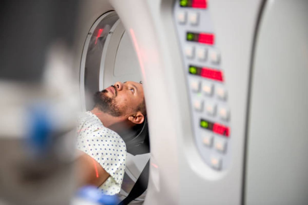 Dolor en el hueso que empeora por la noche o al hacer actividad, hinchazón o inflamación notable en la zona afectada, son algunos síntomas de un tumor óseo.