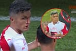 Video: Daniel Torres fue agredido con una moneda por un hincha del Medellín y terminó con el rostro ensangrentado