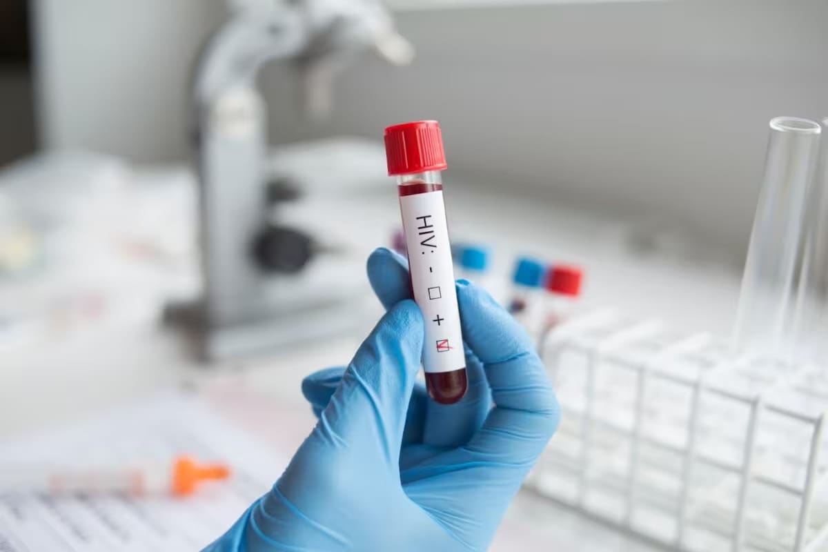 En el caso de obtener un resultado positivo y luego de confirmación de diagnóstico de VIH en un centro de salud de Bucaramanga, el paciente puede recibir atención y acceder al tratamiento.